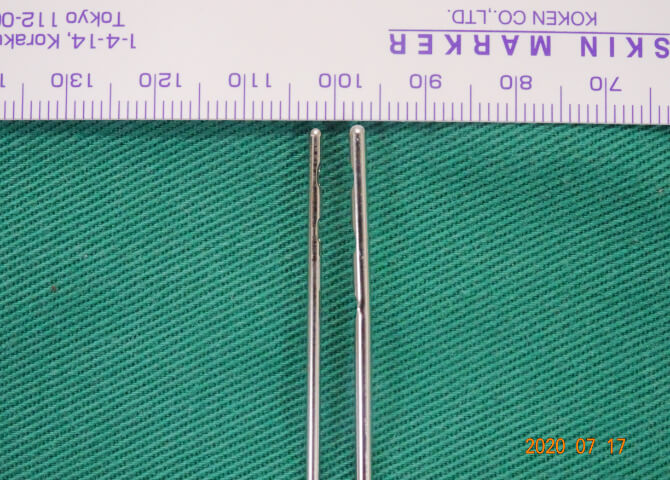 ヒアルロン酸注射画像