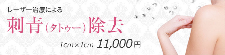 レーザー治療による刺青（タトゥー除去）1cm✕1cm 11,000円