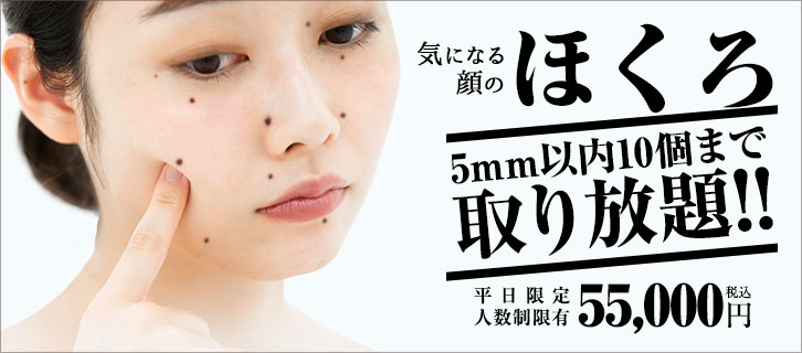 ほくろ取り放題