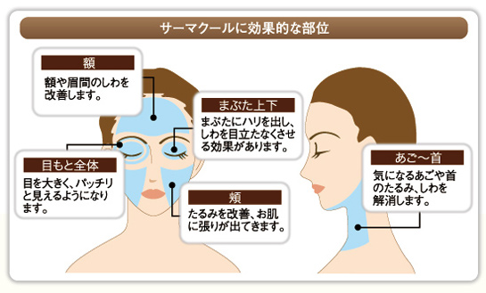 サーマクールが効果的な部位